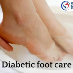 best treatment for footcare for diabetes in erode