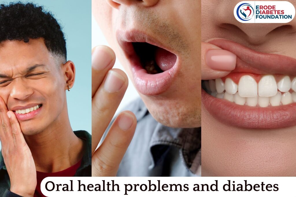 Oral health problems and diabetes-complications and remedies