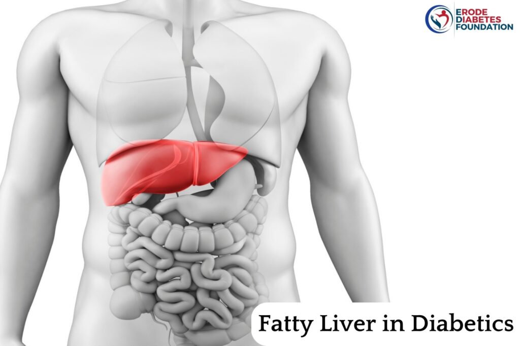 Fatty Liver in Diabetics and its Causes, Symptoms, Risks, and Preventive Measures